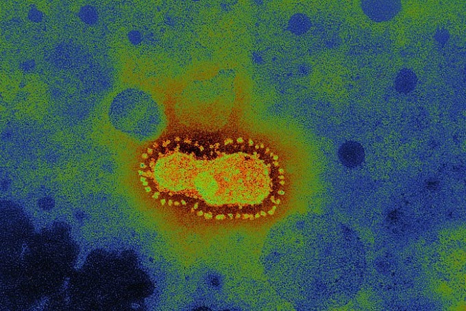 Coronavírus: SARS, MERS e 2019-nCoV  