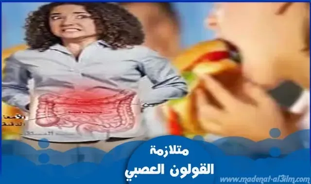 متلازمة القولون العصبي