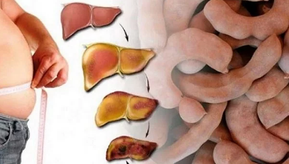 This Fruit Will Cleanse Your Liver And Take Care Of It Better Than Any Medicine!