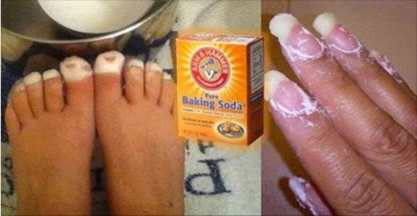 baking soda.