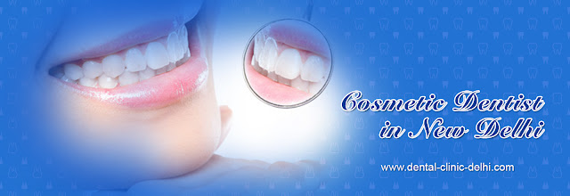 Cosmetic Dental Surgeries in India