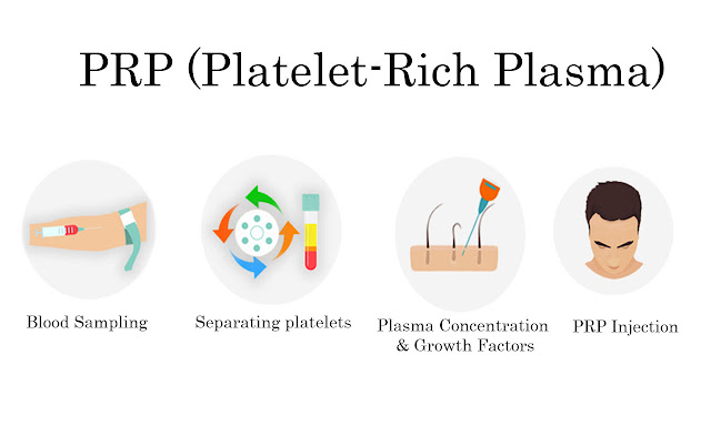 PRP | platelet-rich plasma