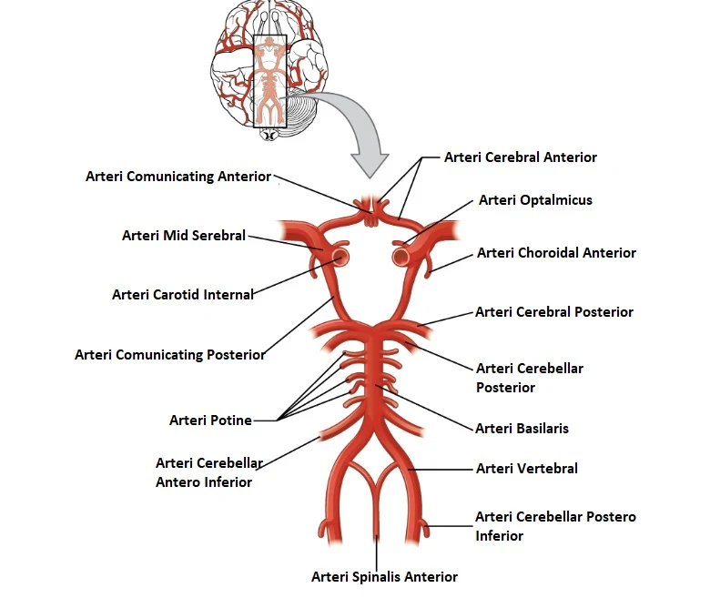 Pasokan Arteri Ke Otak