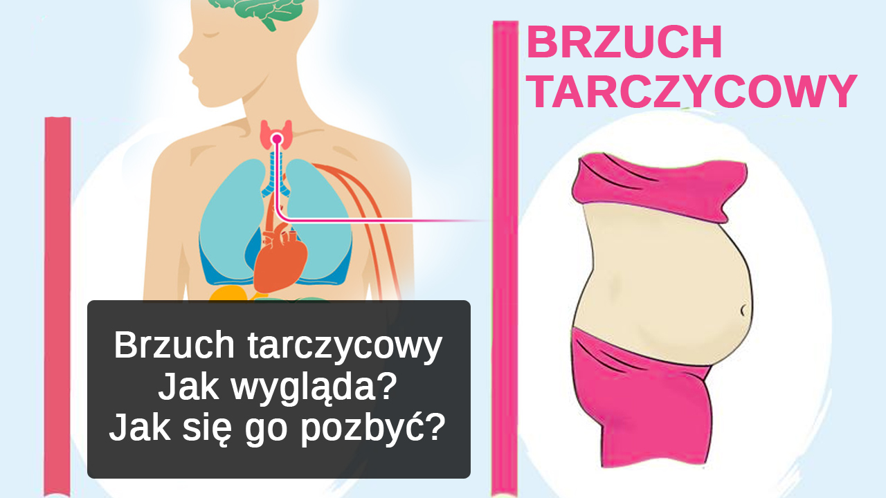 Brzuch tarczycowy - jak wygląda? Jak się go pozbyć?