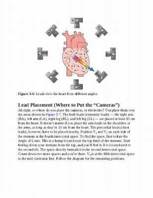 12-Lead ECG: The Art of Interpretation 2nd Edition