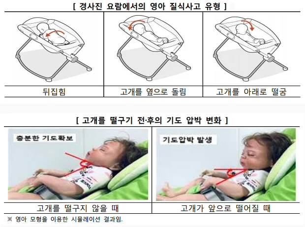 ▲ 경사진 요람에서의 영아 질식사고 유형 및 고개를 떨구기 전·후의 기도 압박 변화