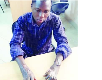 man loses hands torture herbalist