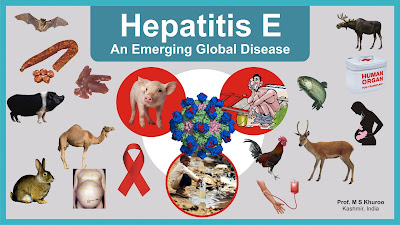 hepatitis e