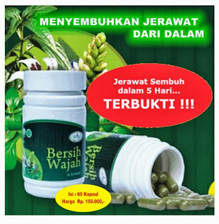 obat jerawat ampuh