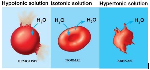 (a) larutan hipotonik (b) larutan isotonik (c) larutan hipertonik yang terjadi pada sel darah merah (Sumber: General chemistry)