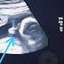 Pai com câncer recebe ‘sinal divino’ em ultrassom do filho: bebê fez ‘V’ de Vitória 
