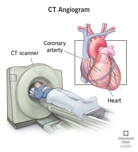 This two tests done on time! it will help to avoid heart attack