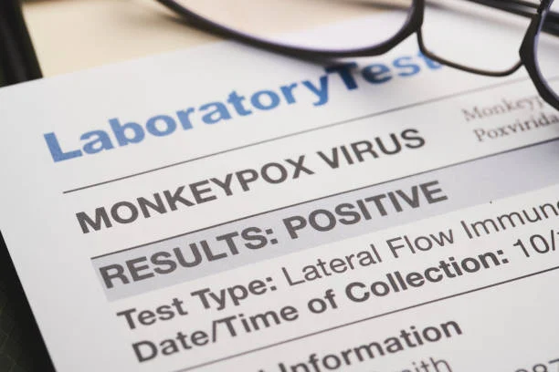 resultados do teste de vírus Monkeypox