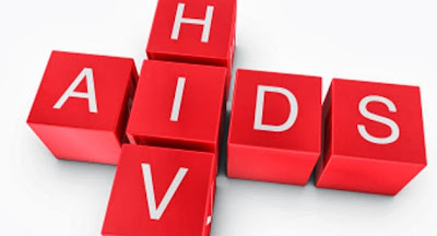 HIV AIDS