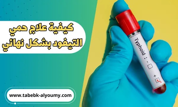 كيفية علاج حمي التيفود بشكل نهائي وفعال