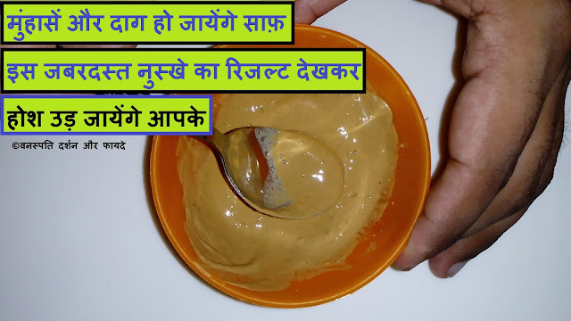 Tremendous Remedy to Clear Acne and Stains the Result with Surprise You