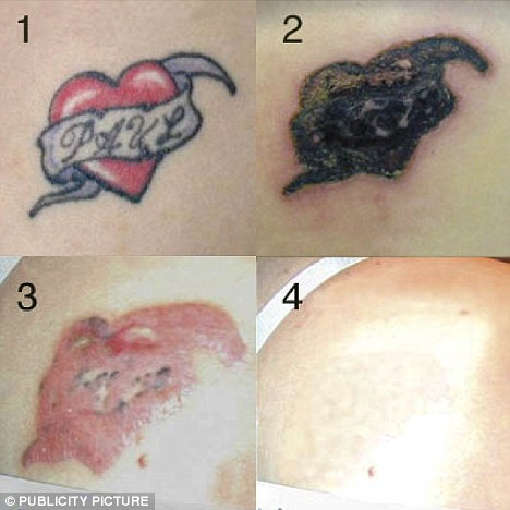 Mucha gente ama sus tatuajes y los conserva para siempre
