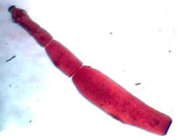 I parassiti intestinali nei cani - Echinococcus granulosus