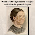 what are the symptoms of lupus and What is Systemic lupus