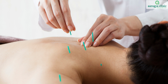 Acupuncture Treatment Near Me in Vellore, India |  Acupuncture and Massage