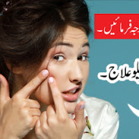 How To Get Rid Of Oil And Pimples - Skin Remedy