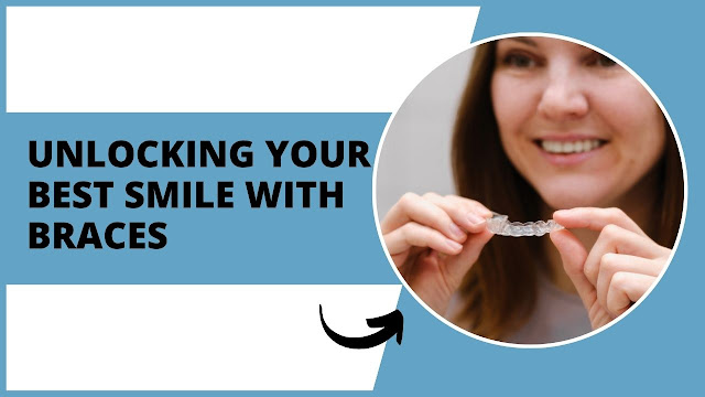 Unlocking Your Best Smile with Braces