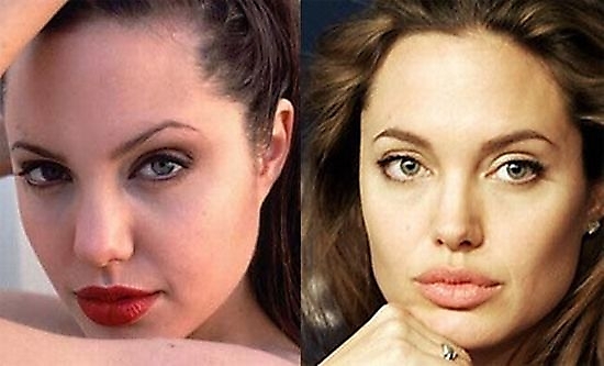 starsplasticsurgery4320%255B1%255D Hollywood Celebs Before & After Surgery