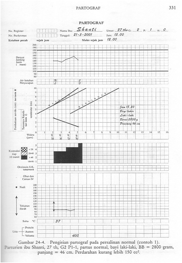 Blog Kesehatan - S1 Keperawatan: Partograf