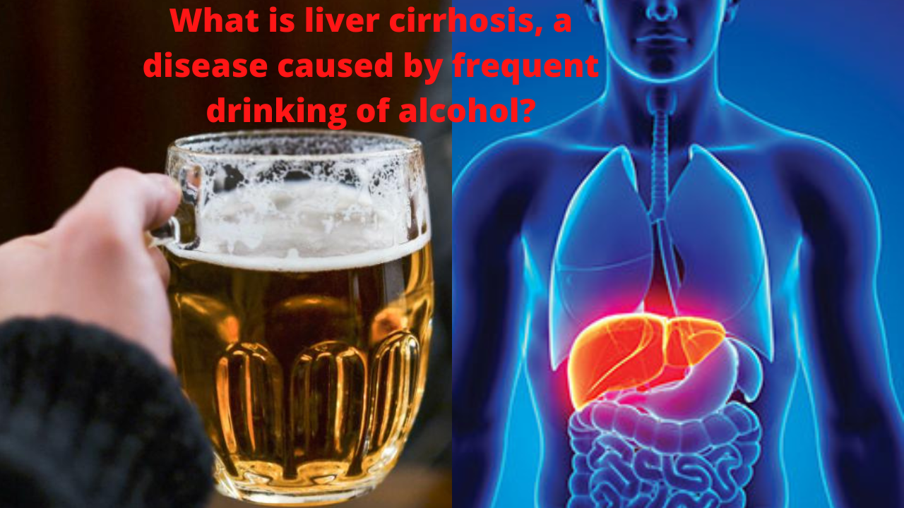 What is liver cirrhosis, a disease caused by frequent drinking of alcohol?