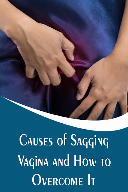 Causes of Sagging Vagina and How to Overcome It
