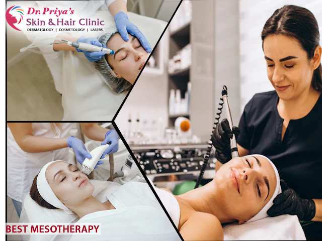 Best Mesotherapy In Marathahalli