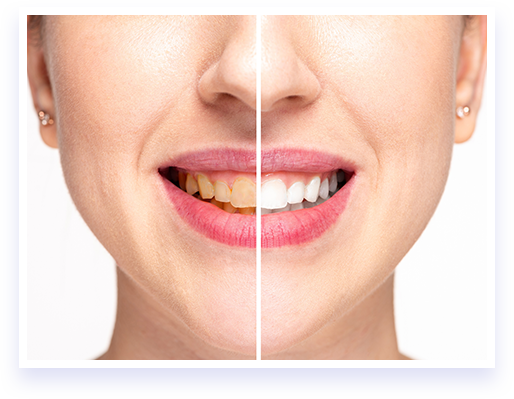 Unlock a Radiant Smile with This 16-Minute Teeth Whitening Trick