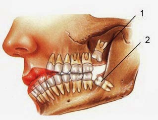 http://www.dentalimplantsclinicindia.com/