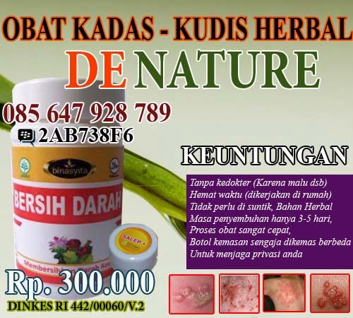 lengkuas obat kadas