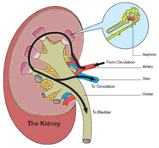 Cara Mengobati Glomerulonefritis Secara Alami