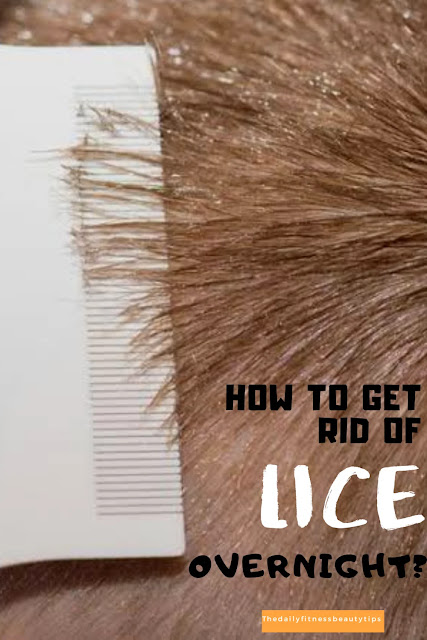 Natural-lice-treatment.