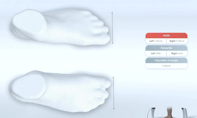 Shoeography: How Aetrex Has Revolutionized Foot Scanning