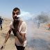 Mengerikan, Tabung Gas Air Mata Israel Tertancap di Pipi Pria Palestina, Ini Foto-fotonya