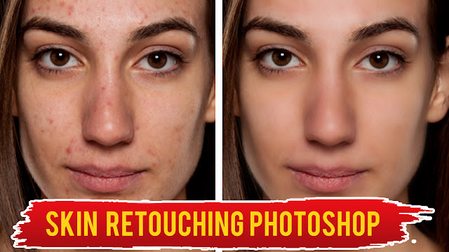 face, acne, skin retouching photo editing photoshop tutorial