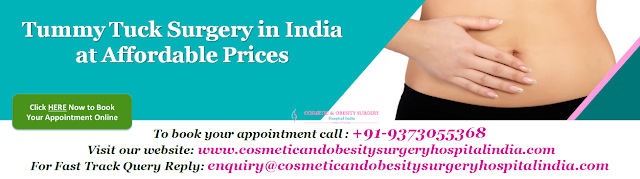 Tummy Tuck Surgery in India at Affordable Prices