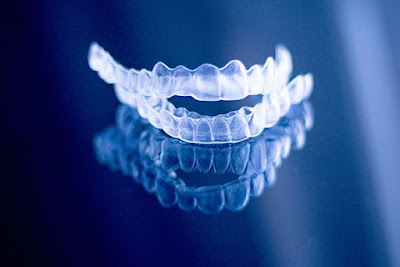 teeth aligners in rajkot