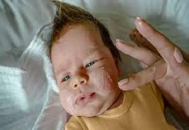 Dealing with children's eczema..do's and don'ts