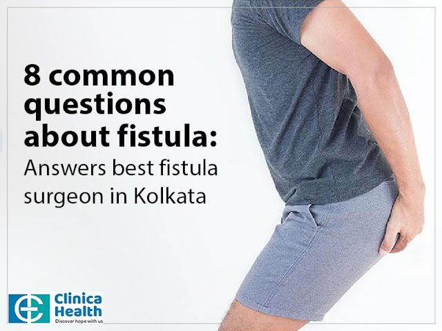 8 Common Questions About Fistula