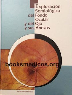 http://booksmedicos.org/exploracion-semiologica-del-fondo-ocular-y-el-ojo-y-sus-anexos/
