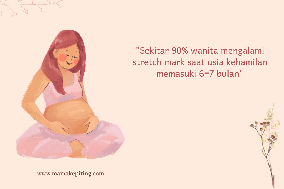 cara mencegah timbulnya stretch mark di masa kehamilan