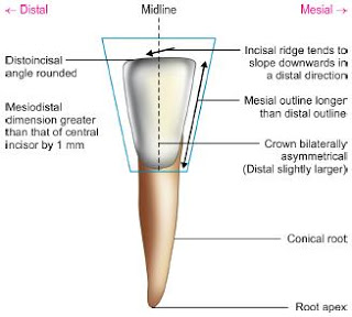labial aspect of Mandibular Lateral Incisor