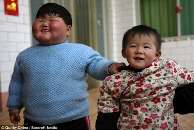 Unbeliveable Chinese Girl Weighs 41.3 Kgs 