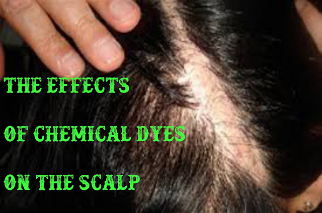 The effects of chemical dyes on the scalp