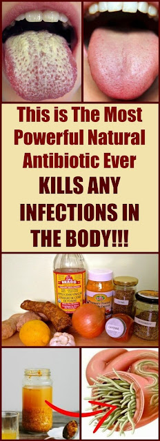 You will be amazed to know! This is The Most Powerful Natural Antibiotic Ever – Kills Any Infections in The Body