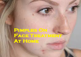 pimple treatment at home